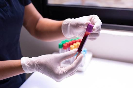 BD Vacutainer Tubes: Understanding Their Role in Blood Collection